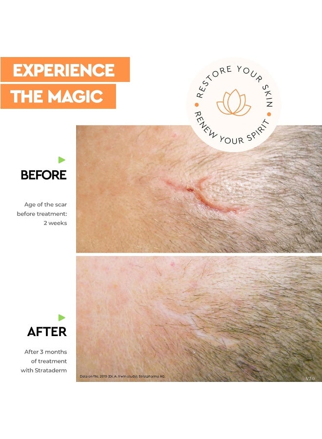 Strataderm Scar Therapy Gel (10g) - Image 3